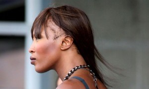 Naomi Campbell showing hair loss