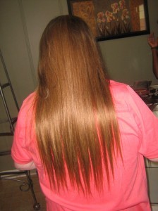 maryclaris_alopecia_patient_after-224x300